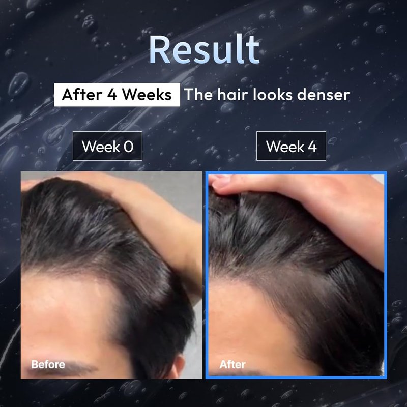 Exosome Hair Growth Brush Ampoule - Revitalize Male Pattern Hair Loss | 3.38 fl. oz.