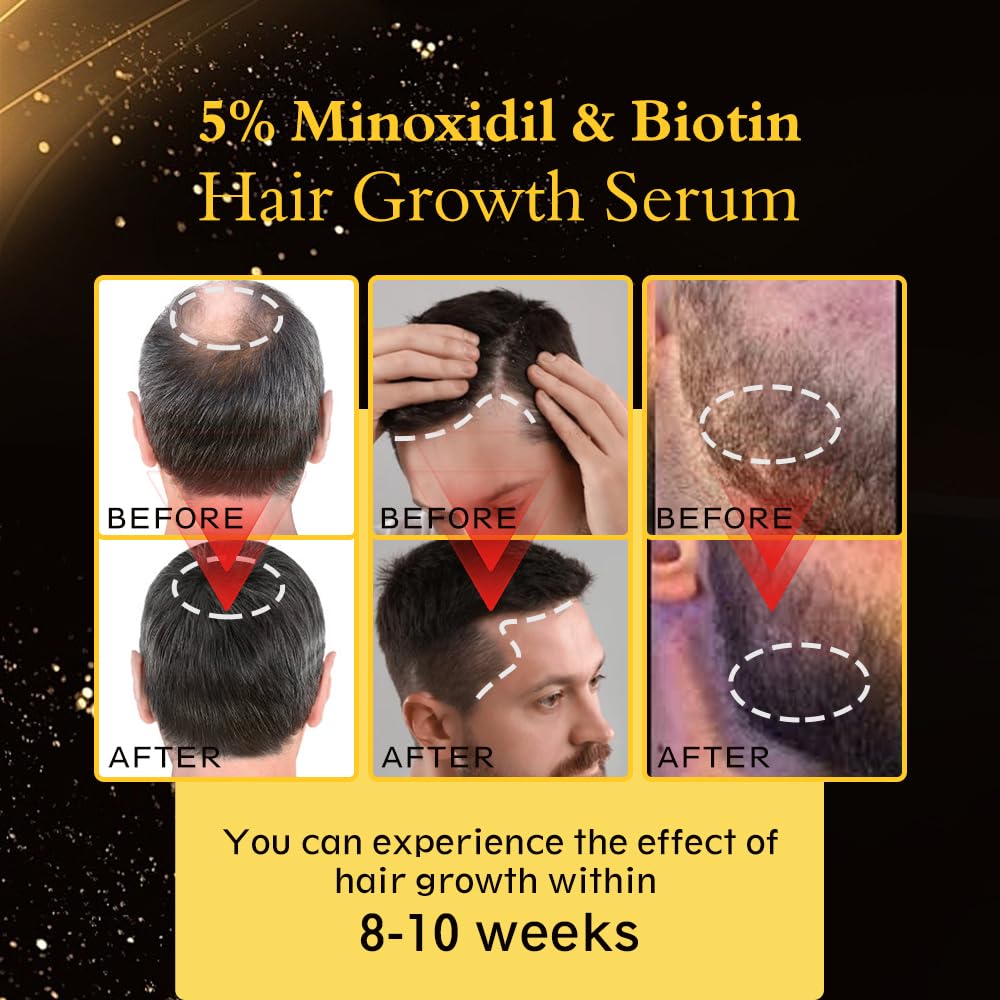 Minoxidil Hair Regrowth Oil - Extra Strength Serum for Thicker, Healthier Hair | 2.11 fl. oz.