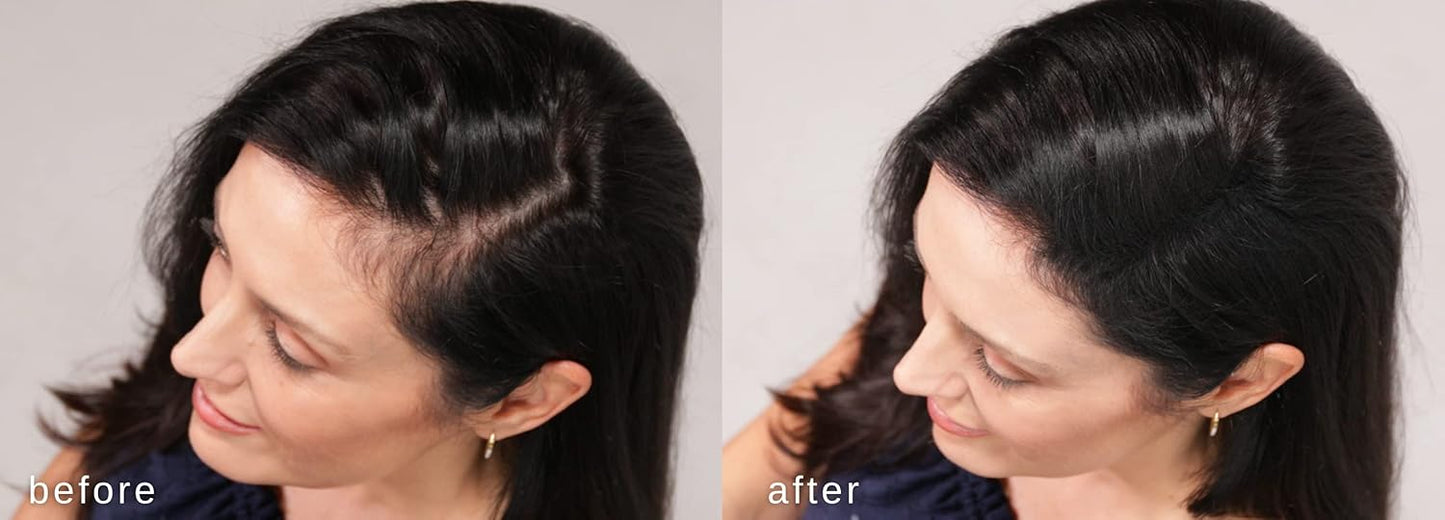 LUXE Hair Building Fibers - Thickening Fibers for Fuller Hair - Hypoallergenic | Auburn Color, 2-Month Supply