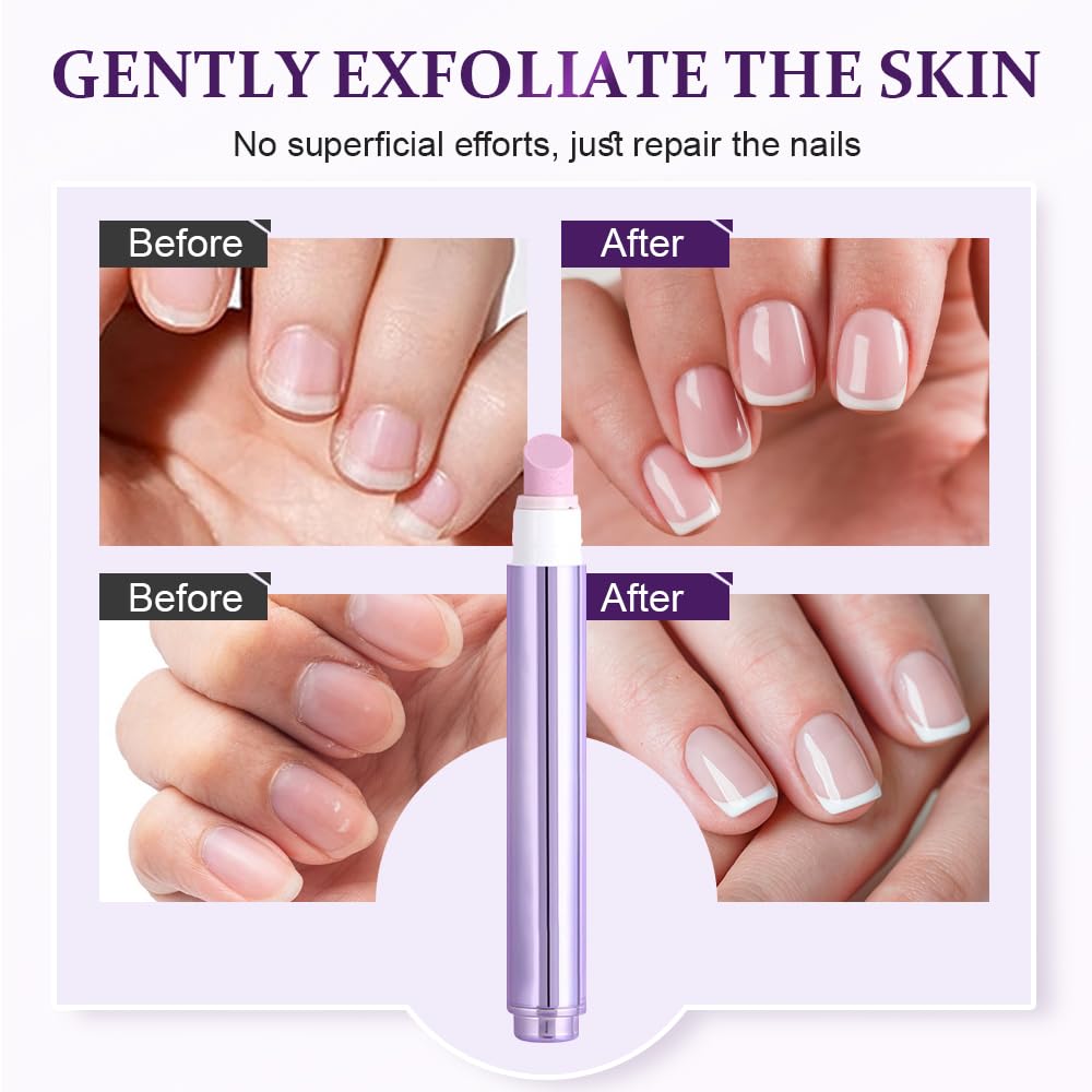 3 In 1 Nail Care Pen - Cuticle Pusher & Nail Oil with Ceramic Tip | Upgrade Treatment for Hangnails & Damaged Nails (1 PC)