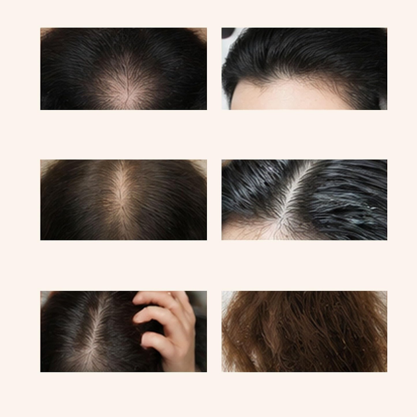 Luna Miracle Hair Growth Oil, Hair Growth Serum, Natural Hair Density Essential Oil, Strengthening Oil Infused Frizzy & Damaged Hair Care to Support Longer, Healthier Strands (2PCS)