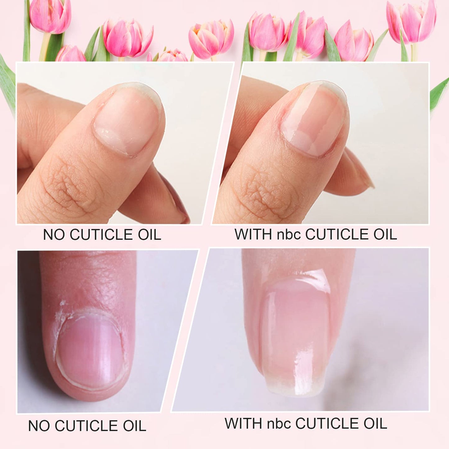 Cuticle Oil Set - 6-Piece Floral Vitamin E Nail Repair & Strengthening