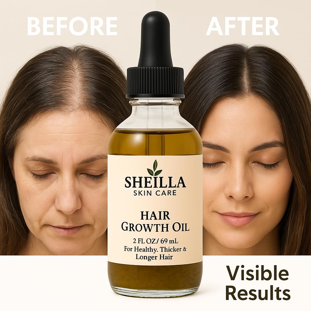 SHEI LLA Skin Care Hair Growth Oil – For Healthy, Thicker & Longer Hair – All Hair Types – 2 oz (59 ml)