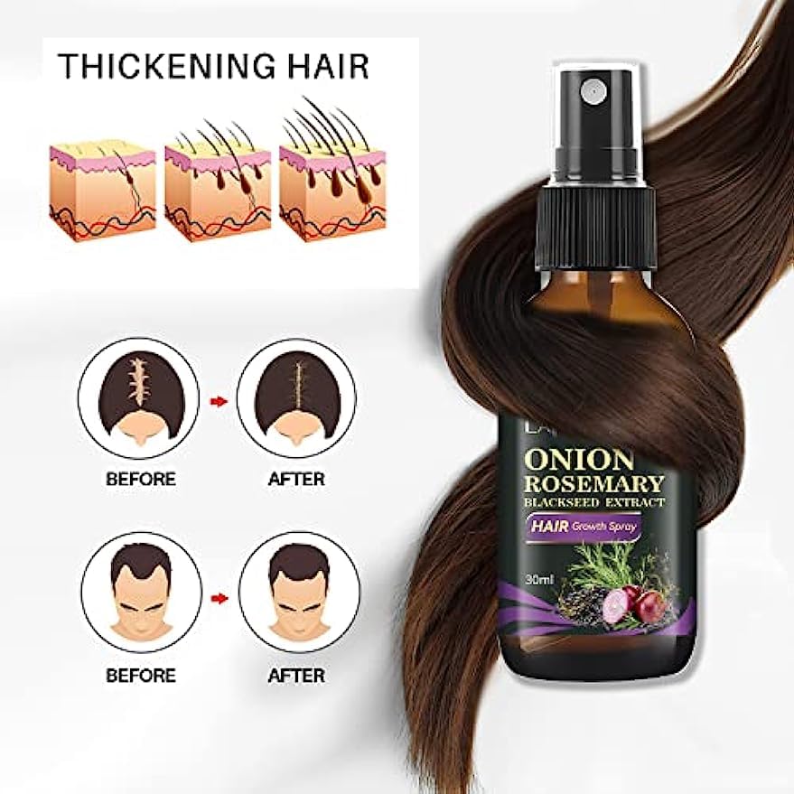 Hair Growth Spray - Rosemary, Onion & Black Seed Formula for Hair Loss Control | Nourishing & Strengthening