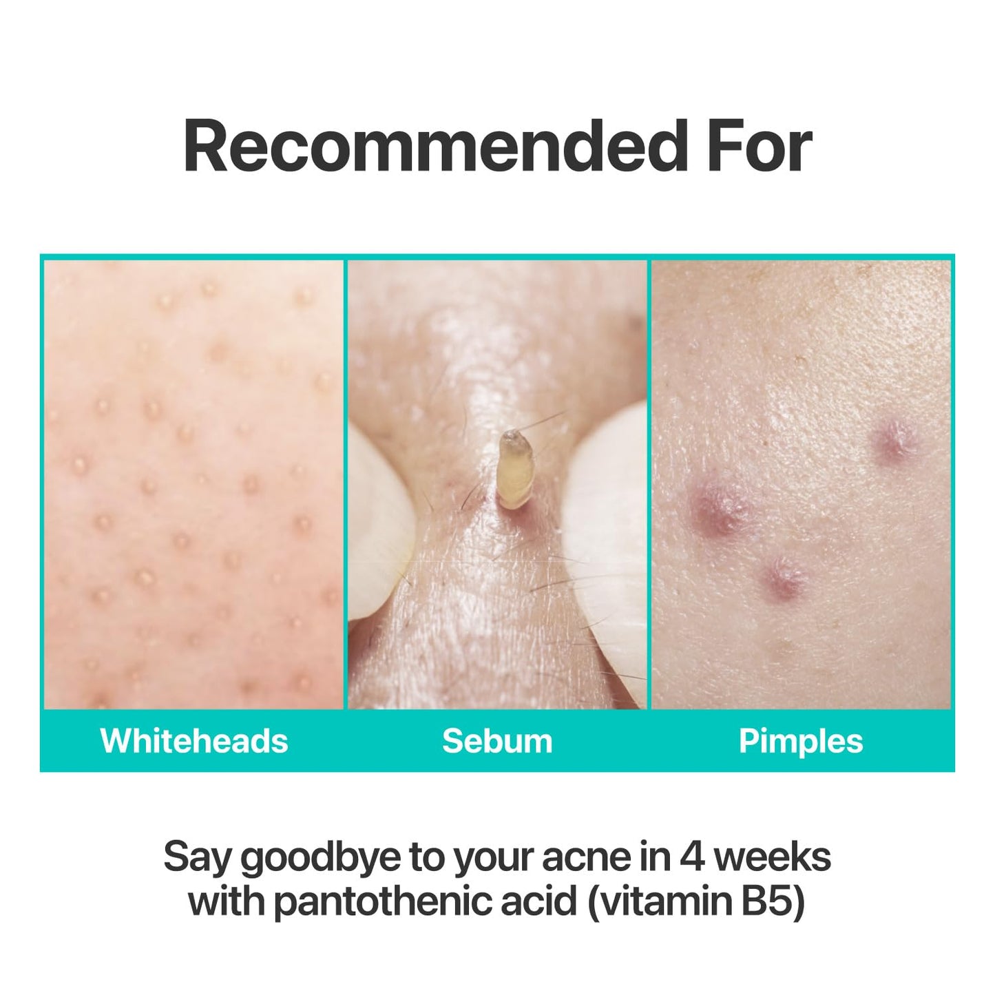 Numbuzin No.1 Pantothenic B5 Soothing Cream - Sebum Control & Skin Repair | 2.70 fl oz