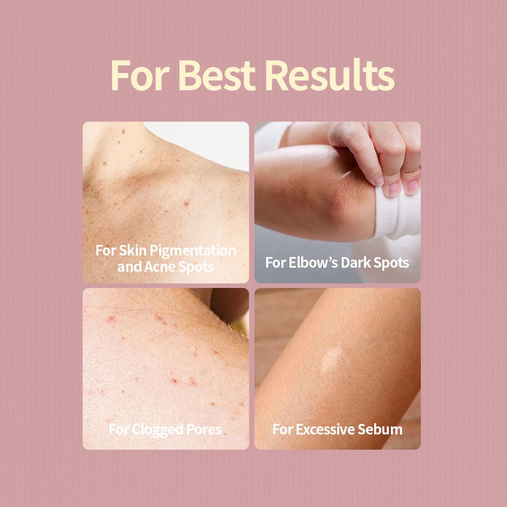 Perfume Body Mist - Daily Moisturizing Spray for Dry, Sensitive Skin | Lightweight & Non-Greasy | 150ml / 5.07 fl. oz. - Dew in Bloom