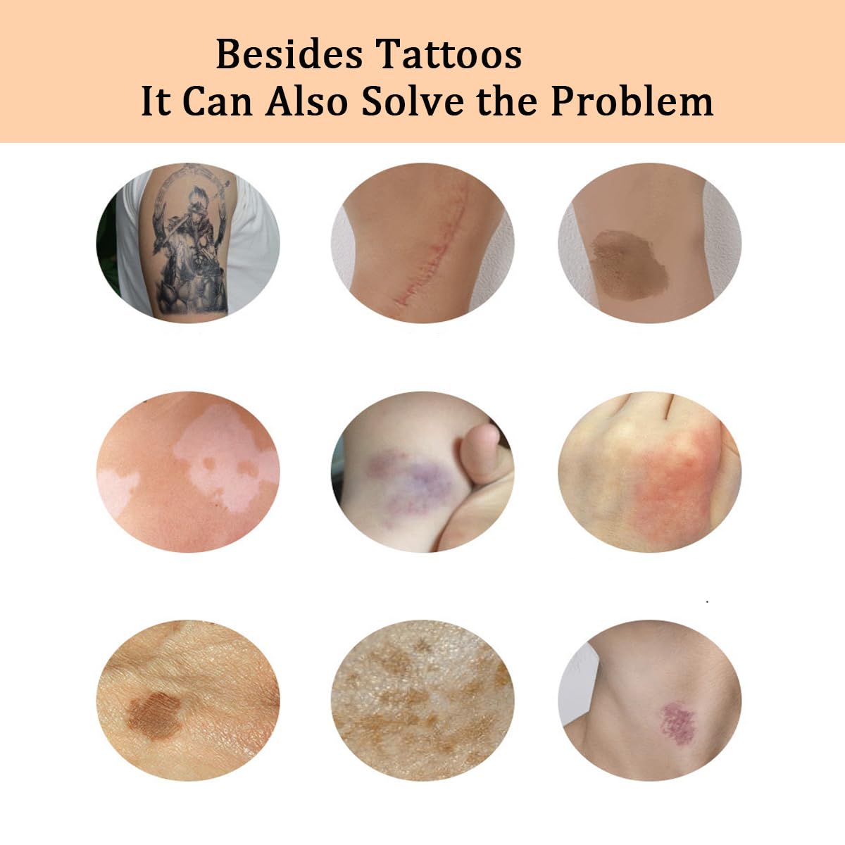 Tattoo Cover Up Makeup,2 Colors Tattoo Concealer - Body & Leg Makeup Waterproof No Transfer,Suitable for Cover Tattoo,Scars,Spots,Adjustabl Color