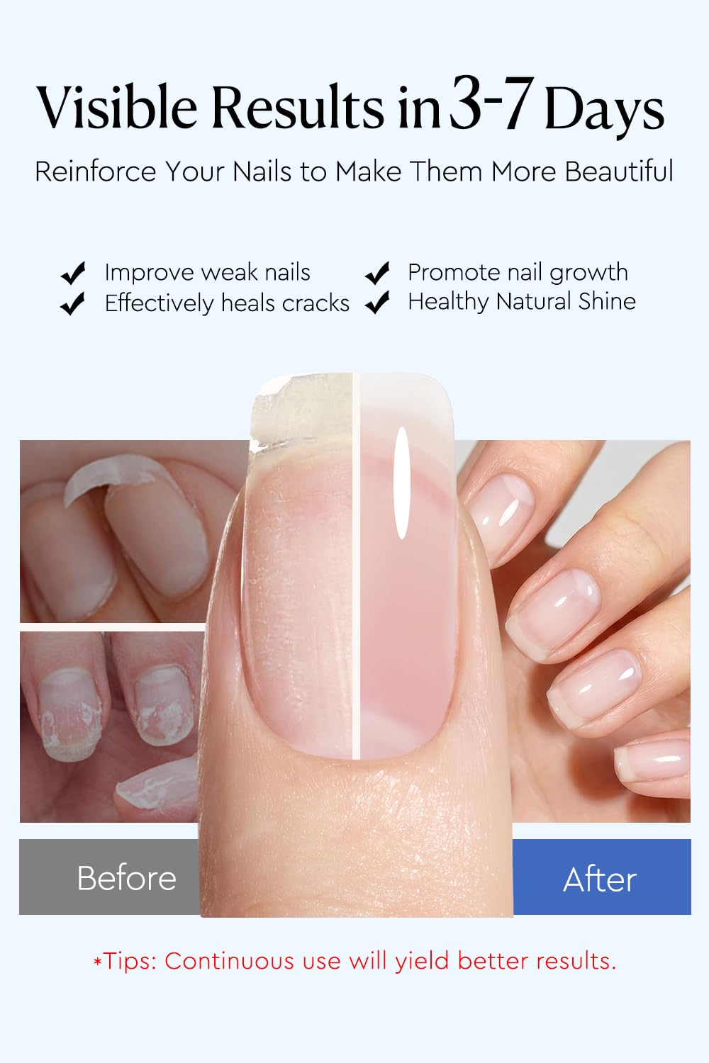 AzureBeauty 18ml Nail Strengthener for Weak & Damaged Nails, Clear Transparent Peel Off Nail Repair Treatment, Ridge Filler & Nail Concealer Foundation, Quick Dry Nail Hardener for Brittle Nails