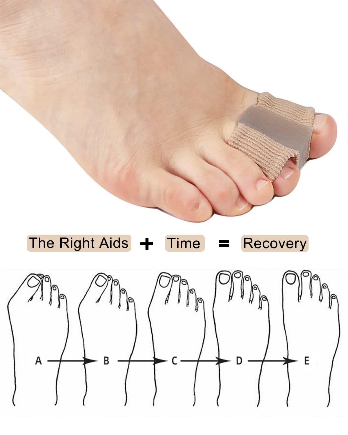 Bunion Toe Separators for Overlapping Toes - Gel Spacers with 2 Loops | Hammer Toe Straightener (2PC)
