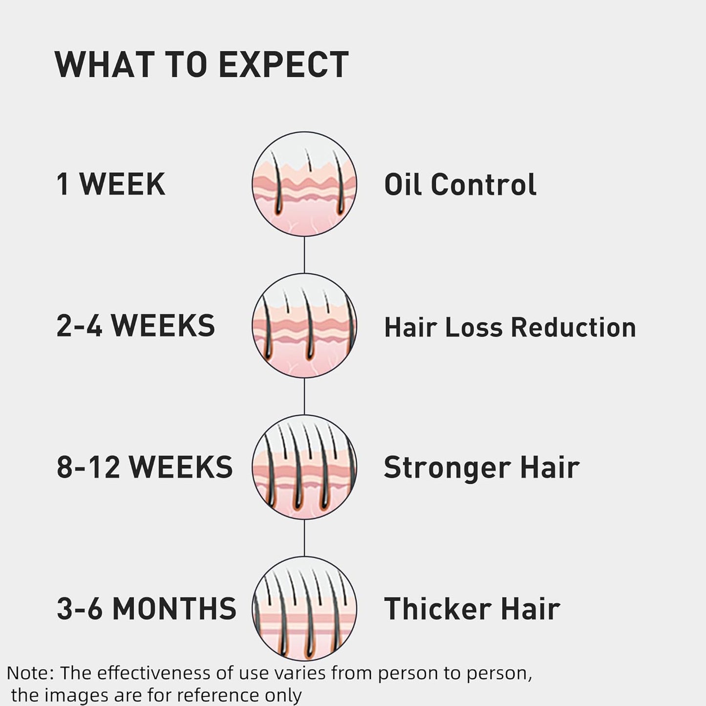 KINTOR KX-826 Hair Growth Spray - 0.5% Formula for Oil Control & Regrowth | 60ml