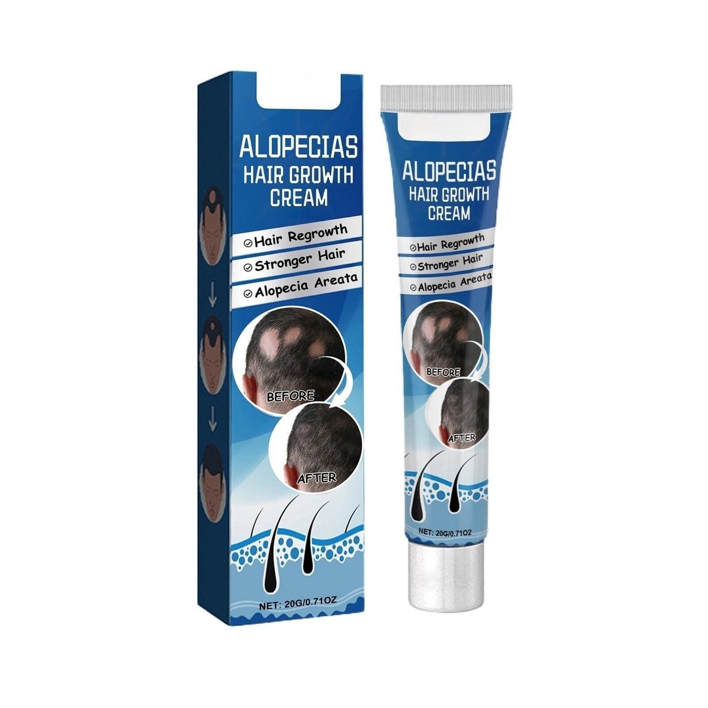 Alopecia Hair Products Suitable for Men & Women