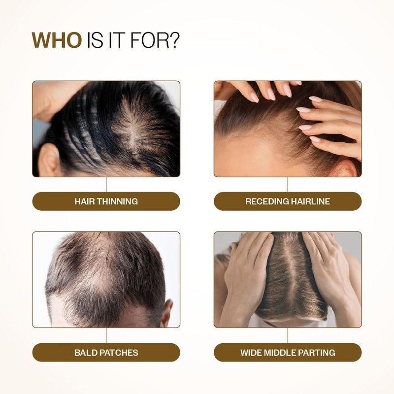 Advanced Hair Density Roll-On | 3% Redensyl, 4% Anagain, 2% Baicapil & Rosemary | Reduces Hair Fall & Supports Growth | 25ml