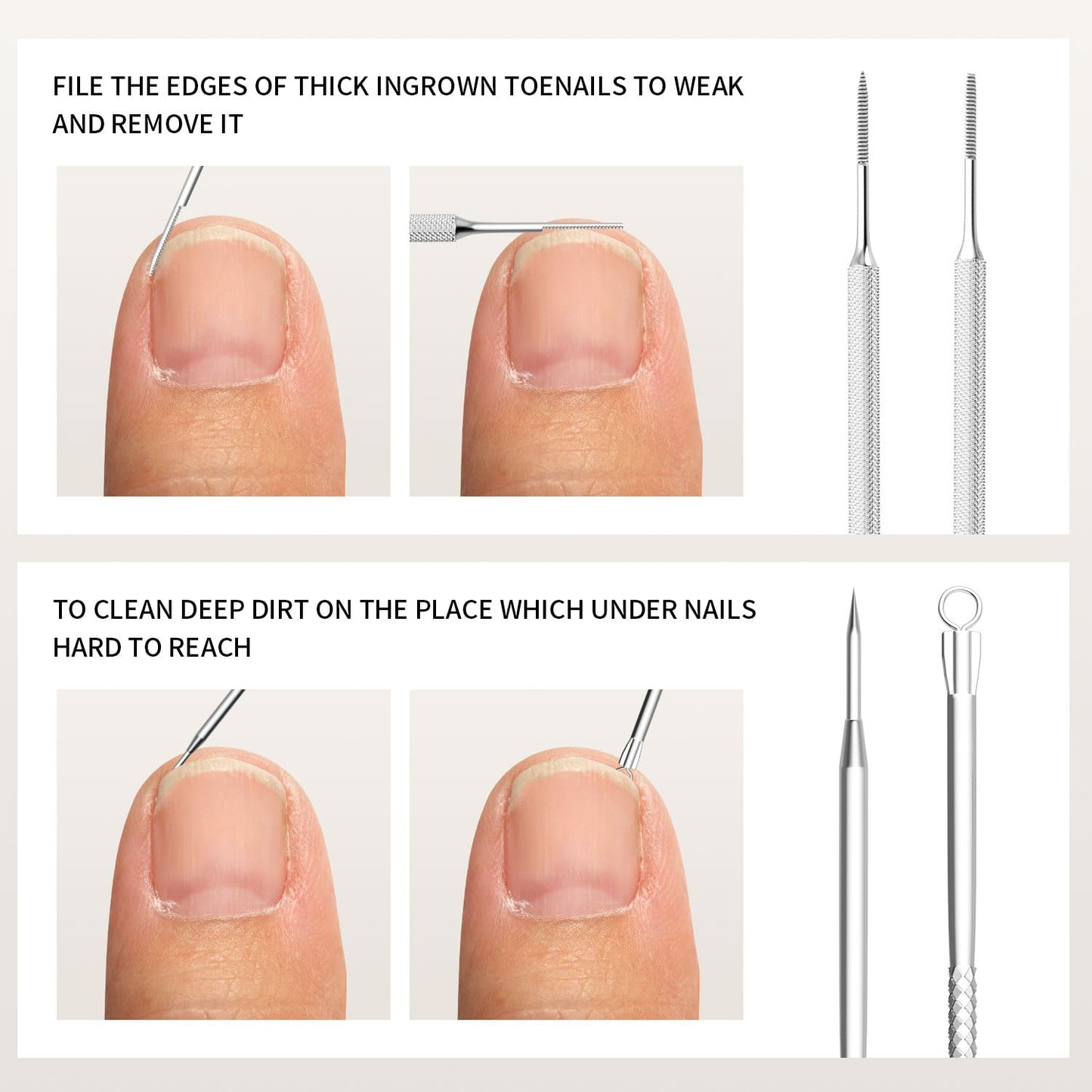 ZIZZON 7 Pcs Ingrown Toenail File and Lifters Set, Stainless Steel Ingrown Toenail Removal Kit, Under Nail Cleaner Pedicure Tools