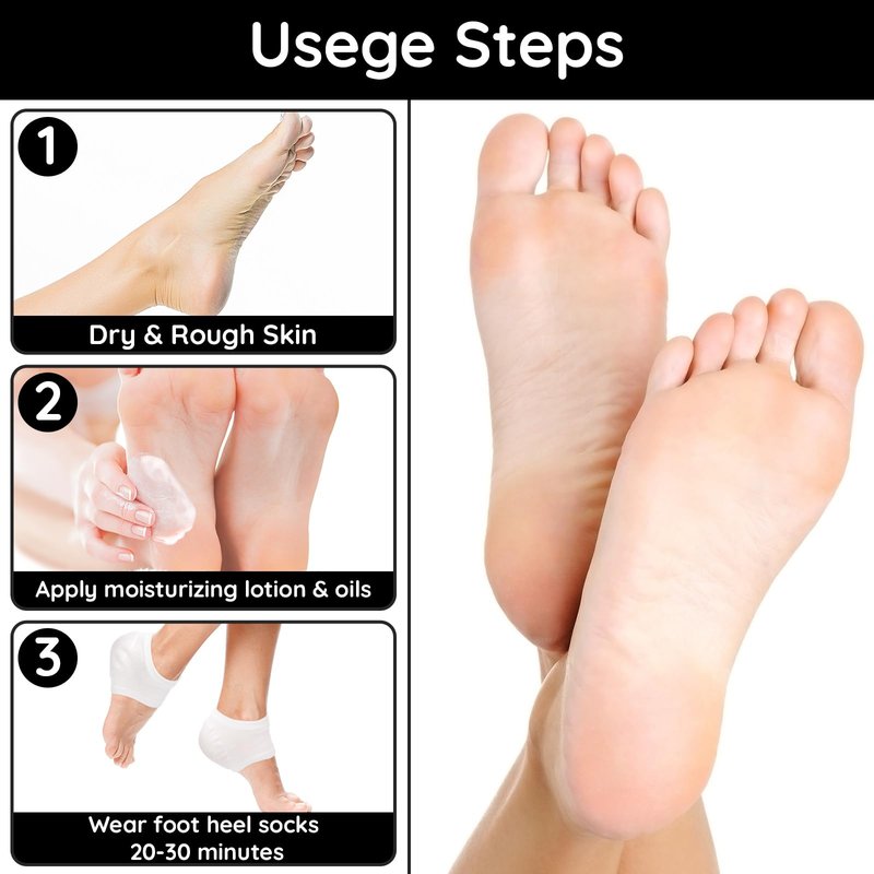 Segbeauty 16pcs Lotion Moisturizing Heel Socks, 8 Pairs Moisturizing Foot Socks Overnight for Cracked Heels Dry Feet, Toeless SPA Sleeping Sock for Men and Women Foot Care, Gel-Lined Sleep Socks Short