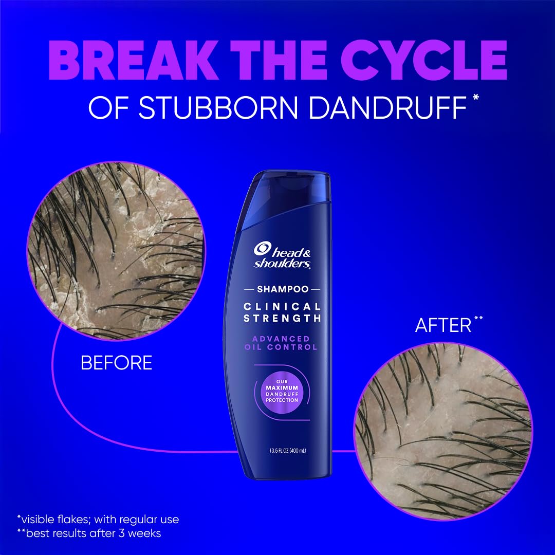 Head & Shoulders Anti-Dandruff Shampoo with 1% Selenium Sulfide, Clinical Strength Advanced Oil Control Twin Pack, Seborrheic Dermatitis Relief, Oily Scalp, 13.5 Fl Oz