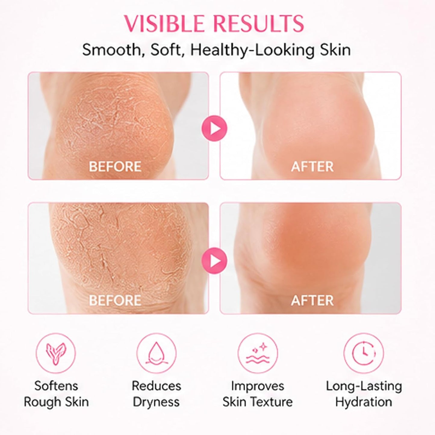 Sakura Foot Heel Stick - Cracked Heel Repair Balm with Shea Butter | 2-Pack, Moisturizing Formula for Hands, Heels, Elbows, Knees