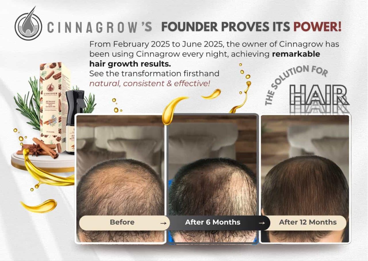 Hair Growth Oil - Rosemary & Cinnamon for Thicker Hair | Nourishing, Lightweight Formula - 60 ml (2 fl oz) with Pump Dispenser
