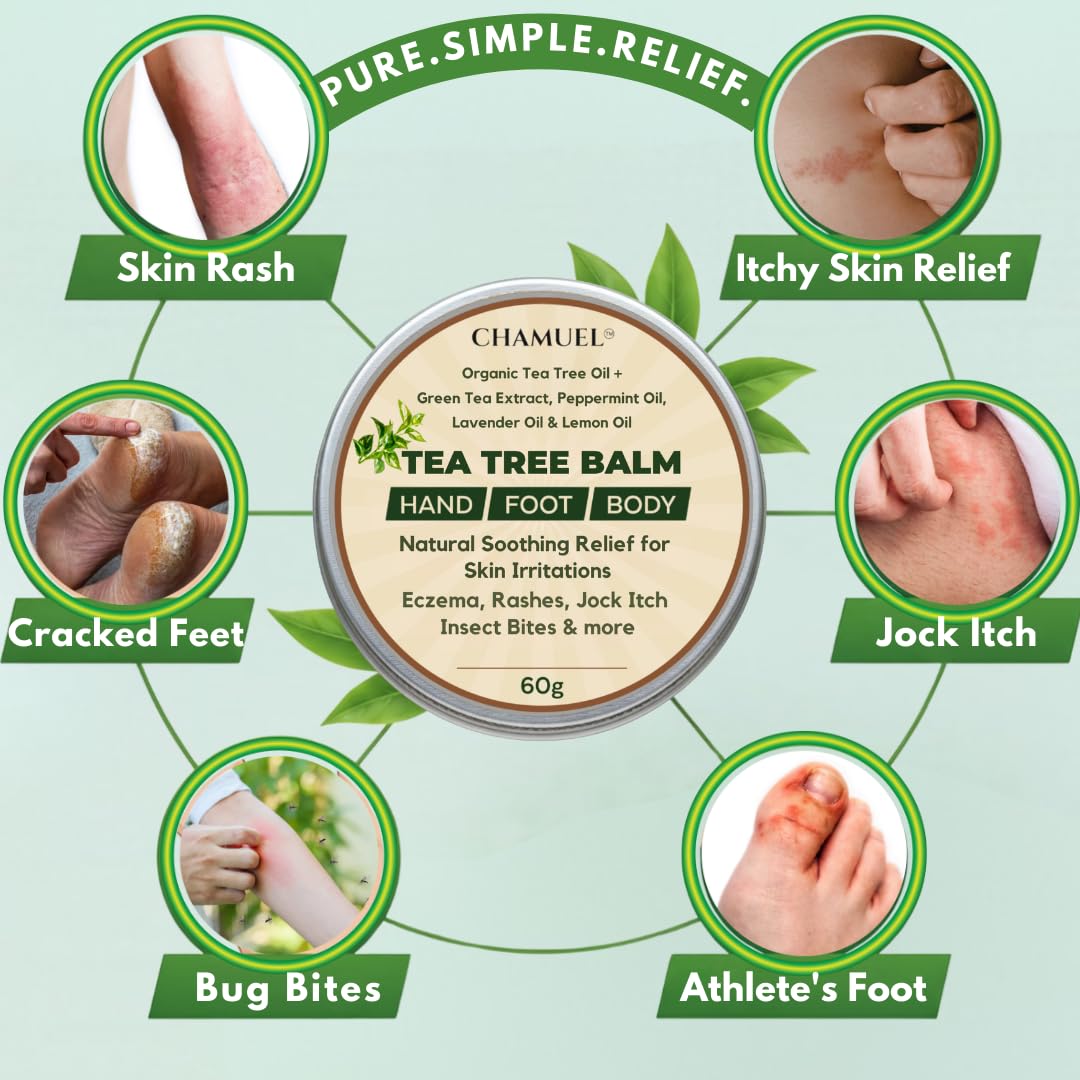 Chamuel Tea Tree Oil Balm – All Natural Moisturizing Cream for Dry Skin, Rough Hands, Cracked Heels, Cuticles & Feet – Hydrating Body Balm for Women & Men, 2-Pack