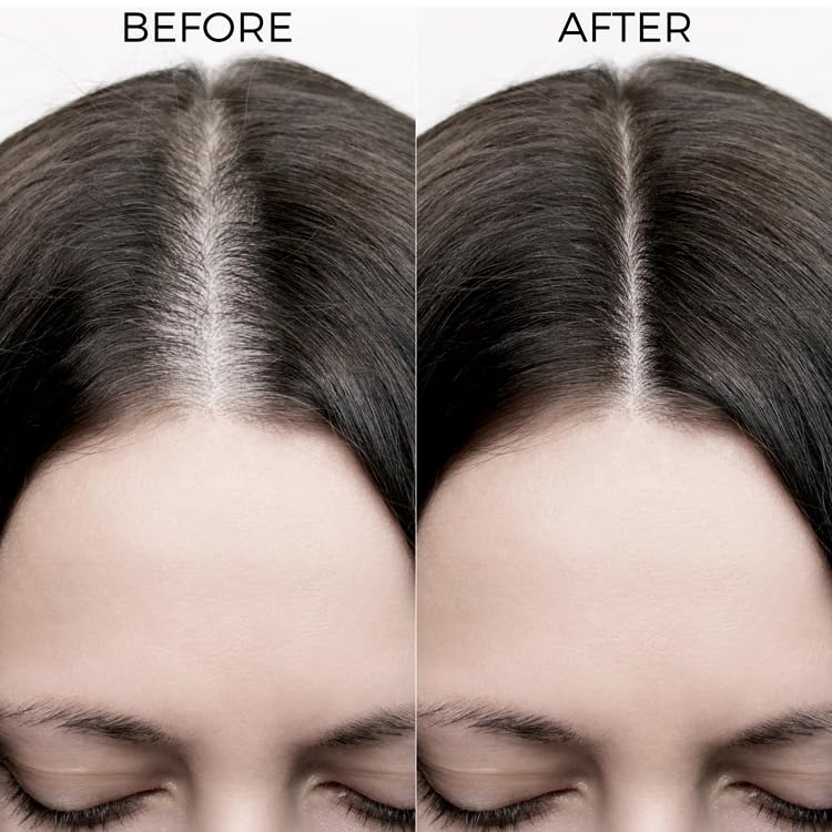 Rosemary Oil Shots for Hair Growth & Thickness - Natural Hair Care Serum