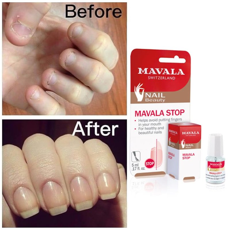 Mavala Stop Deterrent Nail Polish Treatment - Bitter Taste Nail Care for Kids | Easy Application | 0.17 oz
