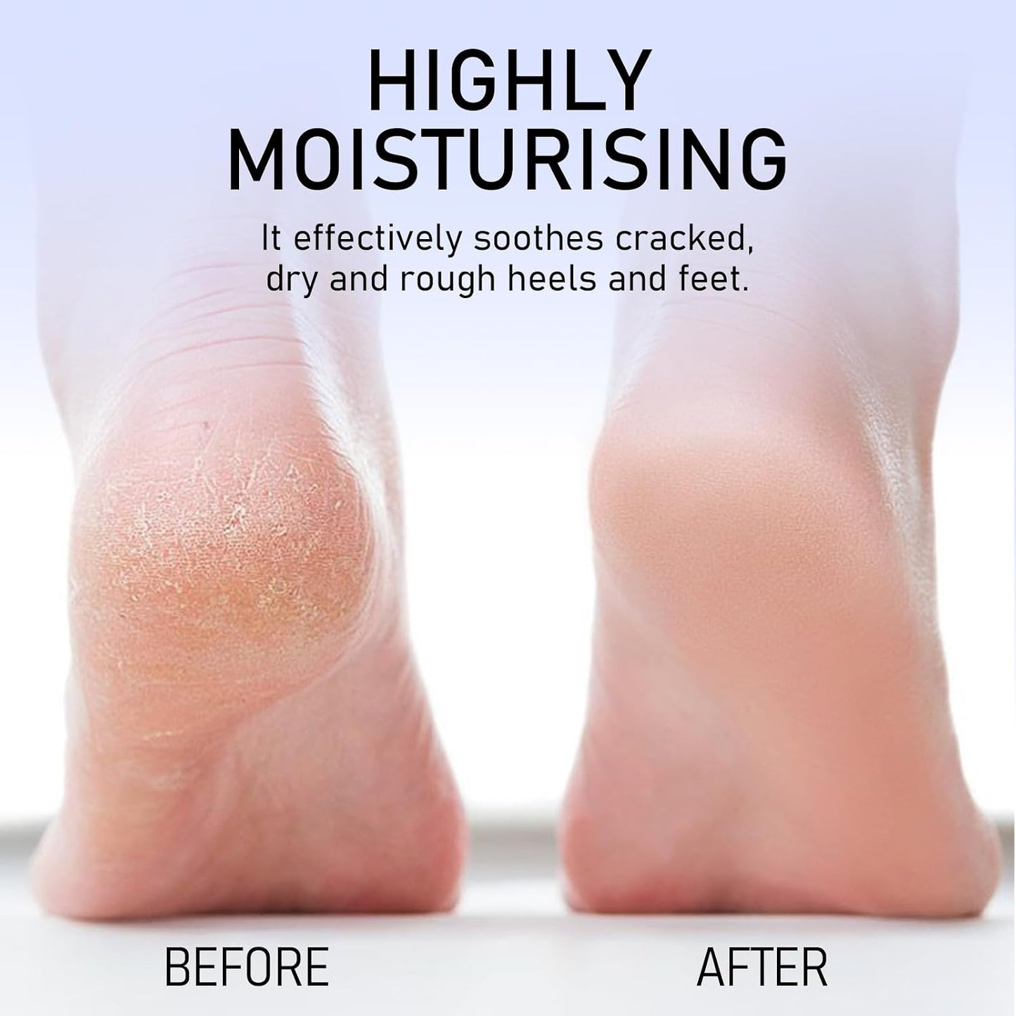 Crack Feet Prevention Stick - Moisturizing Foot & Hand Balm for Softening Dead Skin | Nourishing Anti-Cracking Cream