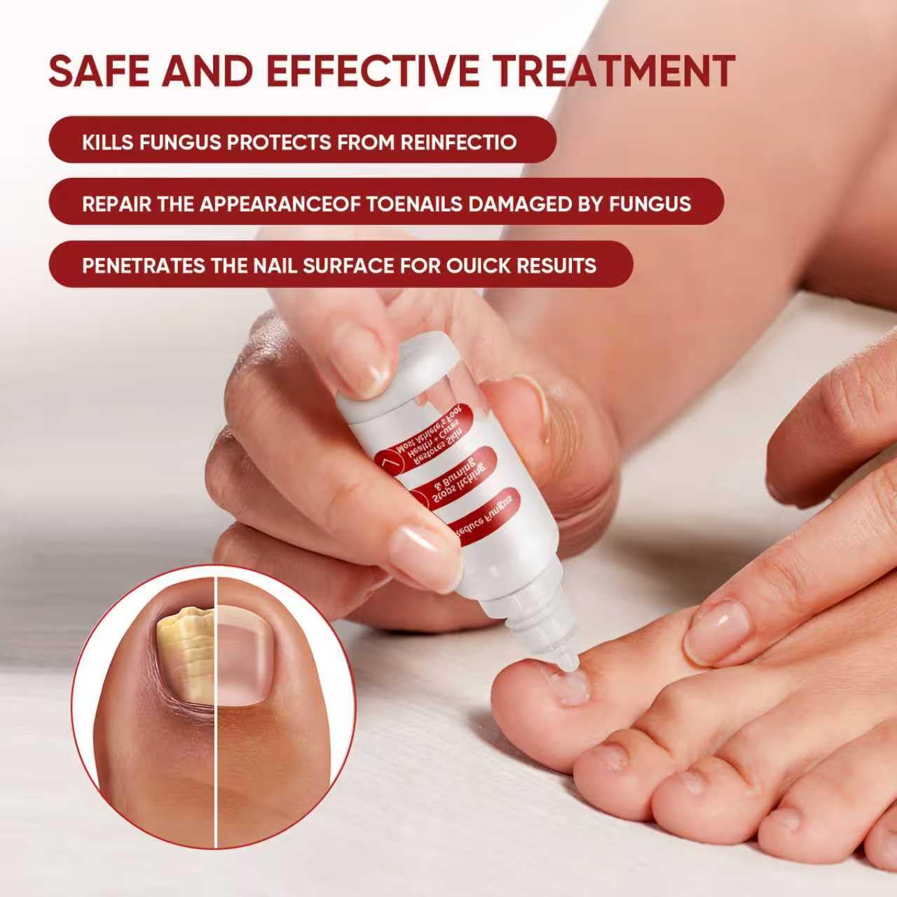 Toenail Treatment - Gentle Formula for Healthy, Beautiful Nails | 1 Piece
