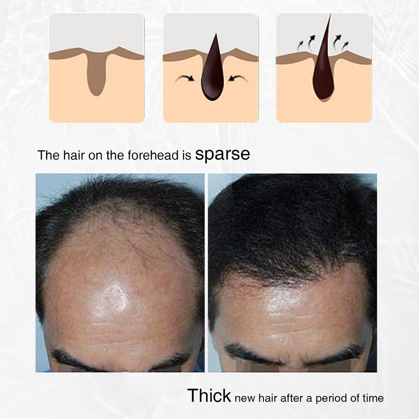 Rosemary, Onion and Black Seed 3-in-1 Hair Growth Spray - Controls Loss and Promotes Growth