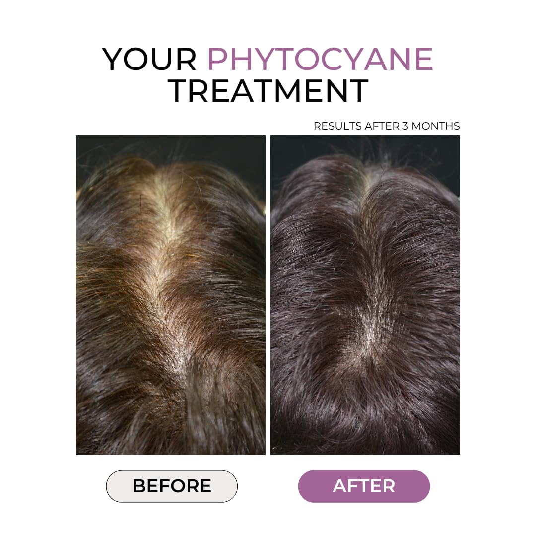 PHYTO PHYTOCYANE Anti-Hair Thinning Dietary Supplement (12-Week Supply), 84 Count (Pack of 1),1 Cap per Day, Vegan, Lactose-Free, Gluten-Free, No Preservatives