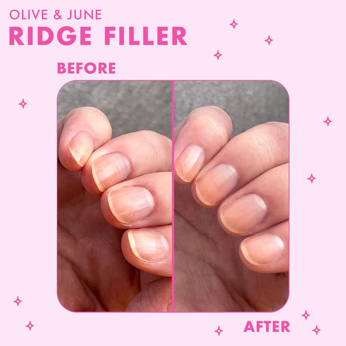 Ridge Filler Nail Base Coat - Smoothing Formula with Vitamin E & Silica | Vegan & Cruelty-Free | 0.46 fl oz