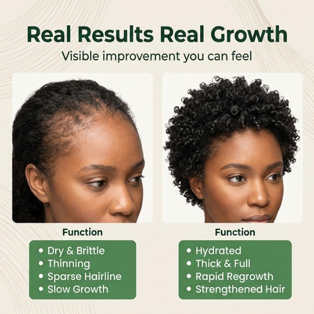 2PCS Oil for Hair Growth, Natural Organic Pure Batana from Honduras, Scalp Oil, Nourishes Scalp, Supports Hair Thickness, Tames Frizz & Adds Shine for Men & Women