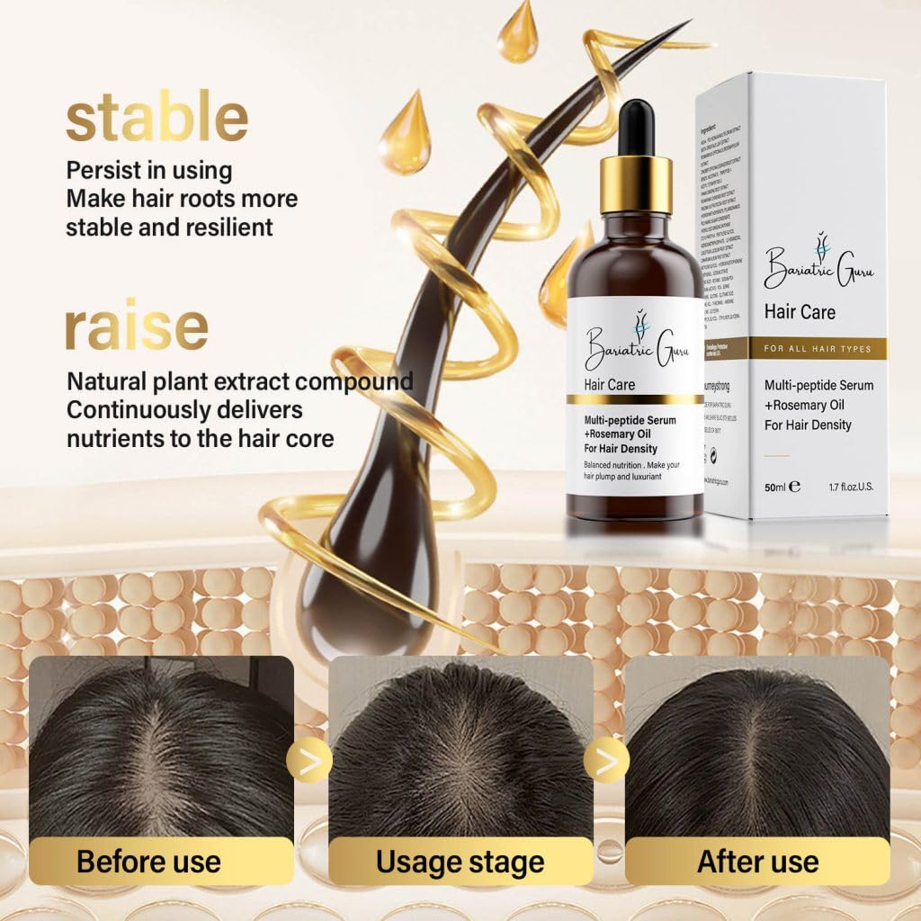 Bariatric Guru Hair Growth Serum with Multi-Peptides, Rosemary Oil, Biotin, Fo-Ti & Ginger – Nourishing Scalp Oil for Thinning Hair, Supports Thickness & Fullness for Women & Men, 50ML