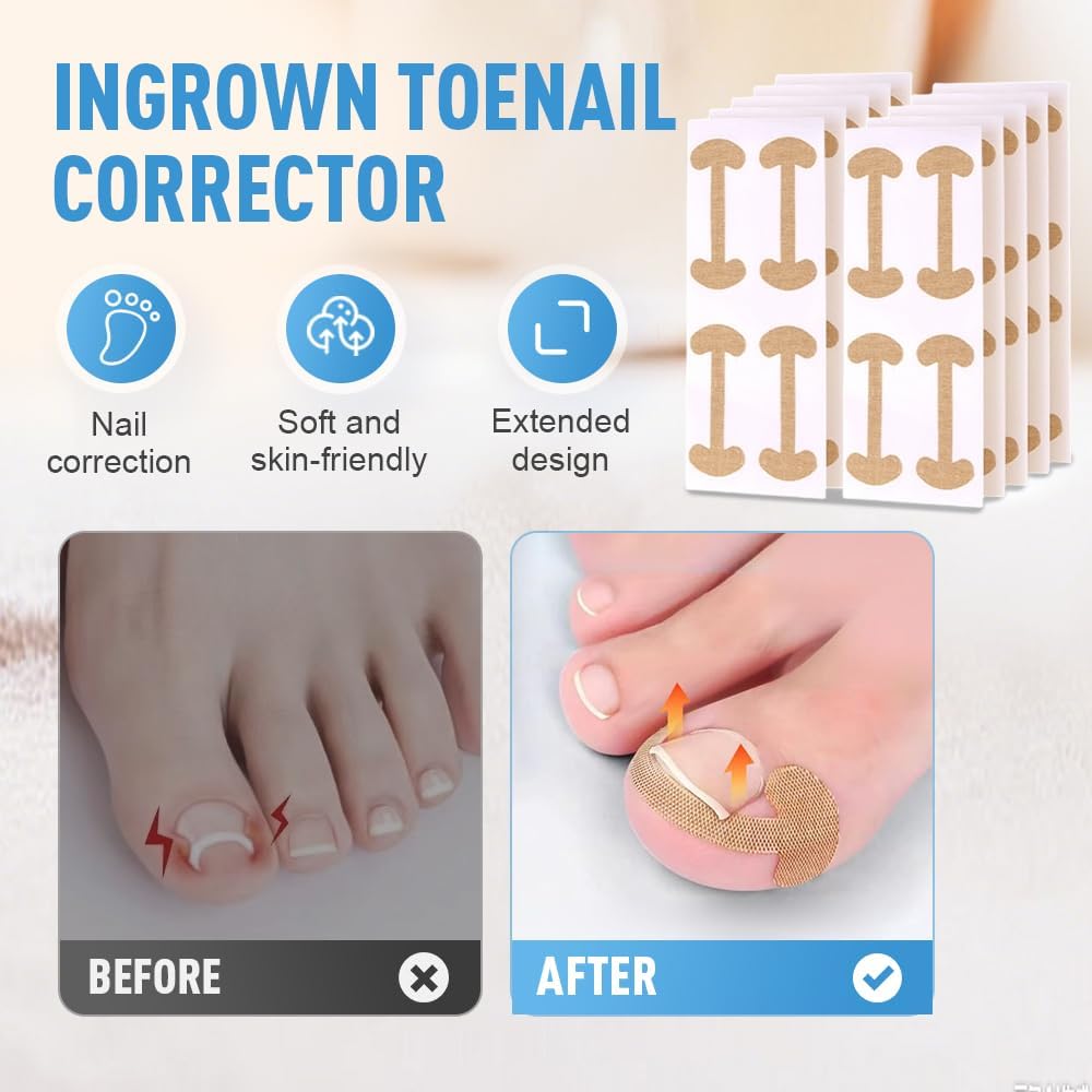 Ingrown Toenail Corrector Set,Curved Toenails Corrector Strips, Painless File and Lifter Pedicure Tools for Women Man with Breathable Ingrown Nail Correction Patch(16 PCS)