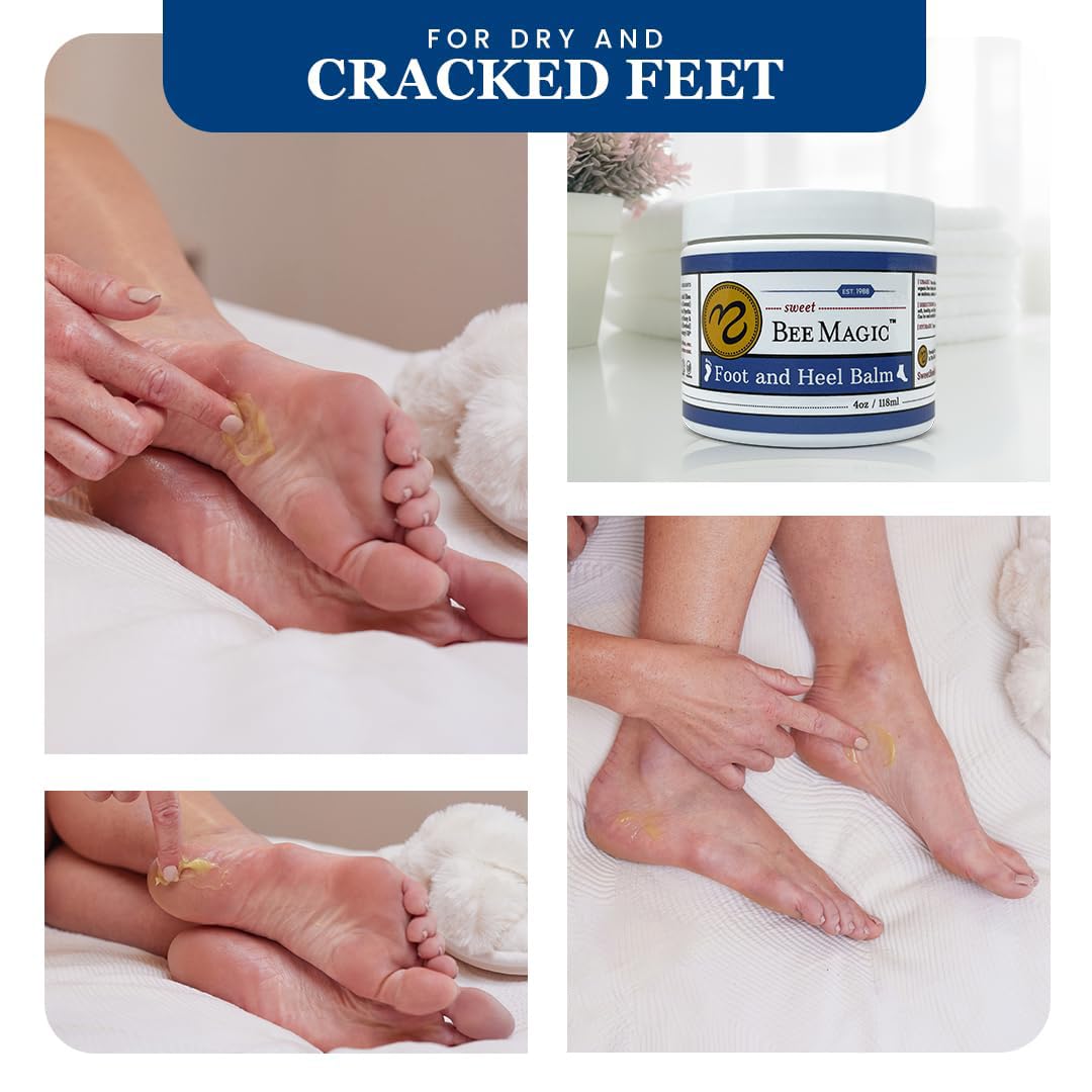 Organic Foot Balm - Intensive Heel Treatment for Dry, Cracked Feet | Natural Moisturizer - 4 OZ Jar