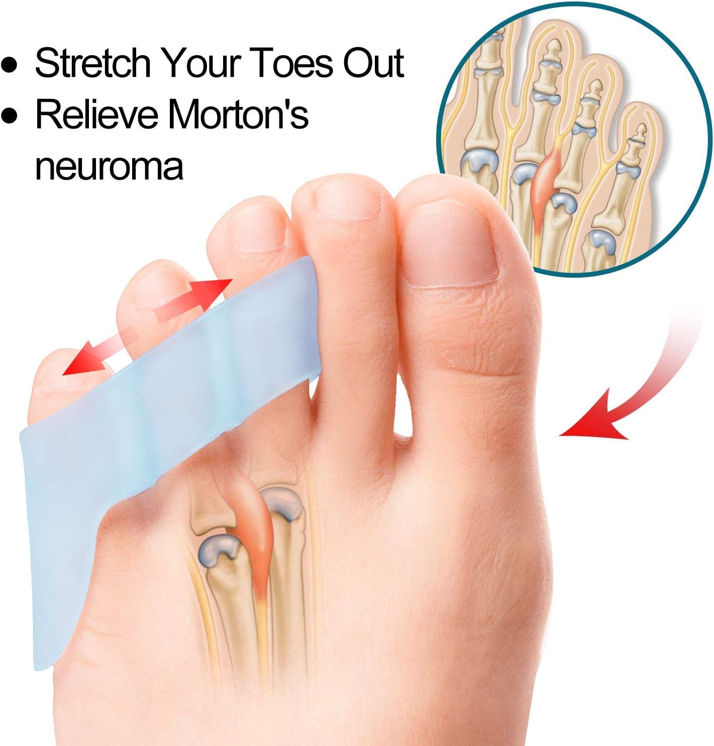 Povihome 10 Pack Pinky Toe Separator and Protectors for Overlapping Toe, Curled Pinky Toes - Spacers for Morton's Neuroma Pain Relief