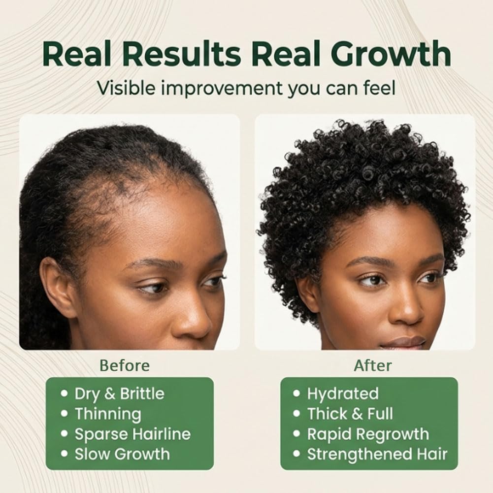 Batana Oil for Hair Growth - Natural Treatment for Thicker, Healthier Hair | 1 oz