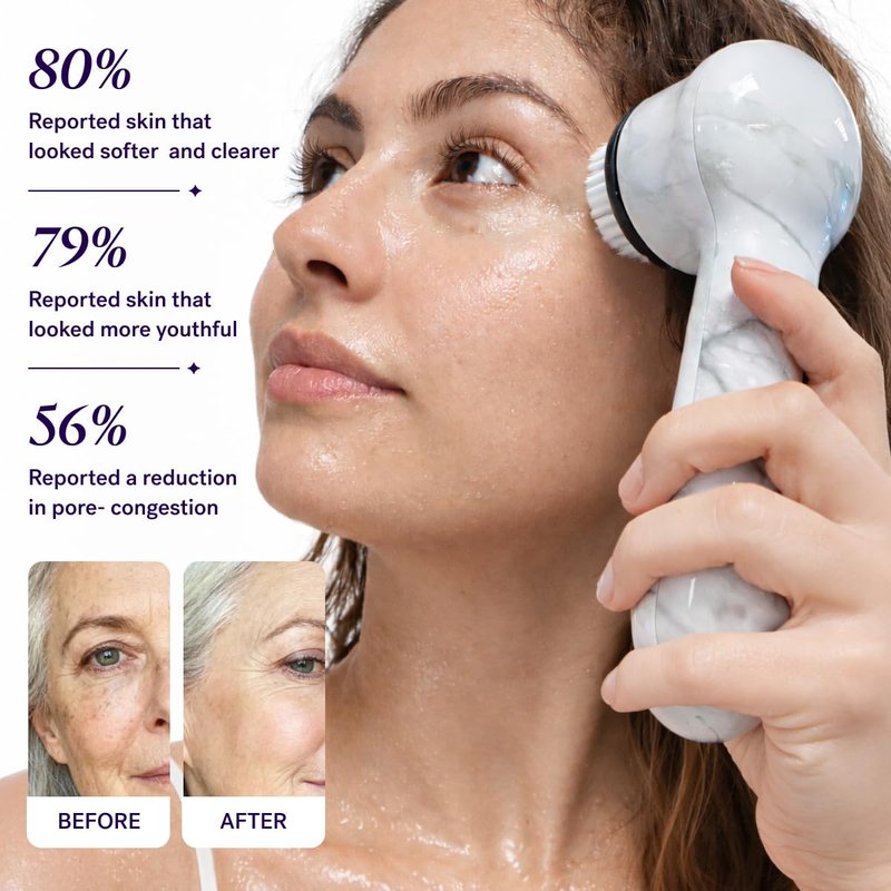 Michael Todd Beauty Soniclear Allure 2026 Reader’s Choice Award Winner Facial Cleansing + Exfoliation Brush System with Antimicrobial Protected Bristles, 4 Speeds, Serum Infusion Head + Travel Case