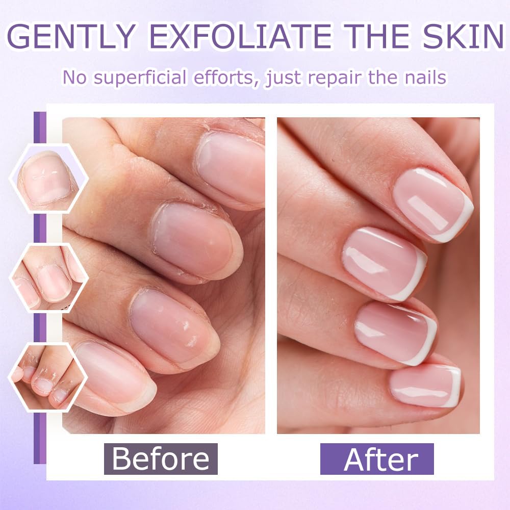 Nail Care Pen - 3-in-1 Cuticle Oil with Ceramic Tip for Hangnails & Dry Nails | Nourish & Strengthen (2 Pack)
