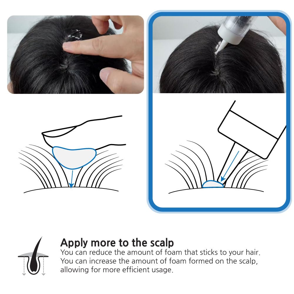 INVENEED Minoxidil Foam Applicator - Targeted Scalp Dispenser for Hair Loss - Patented Tech (KR/US) - Mess-Free, Reusable Tool (Foam Not Included)