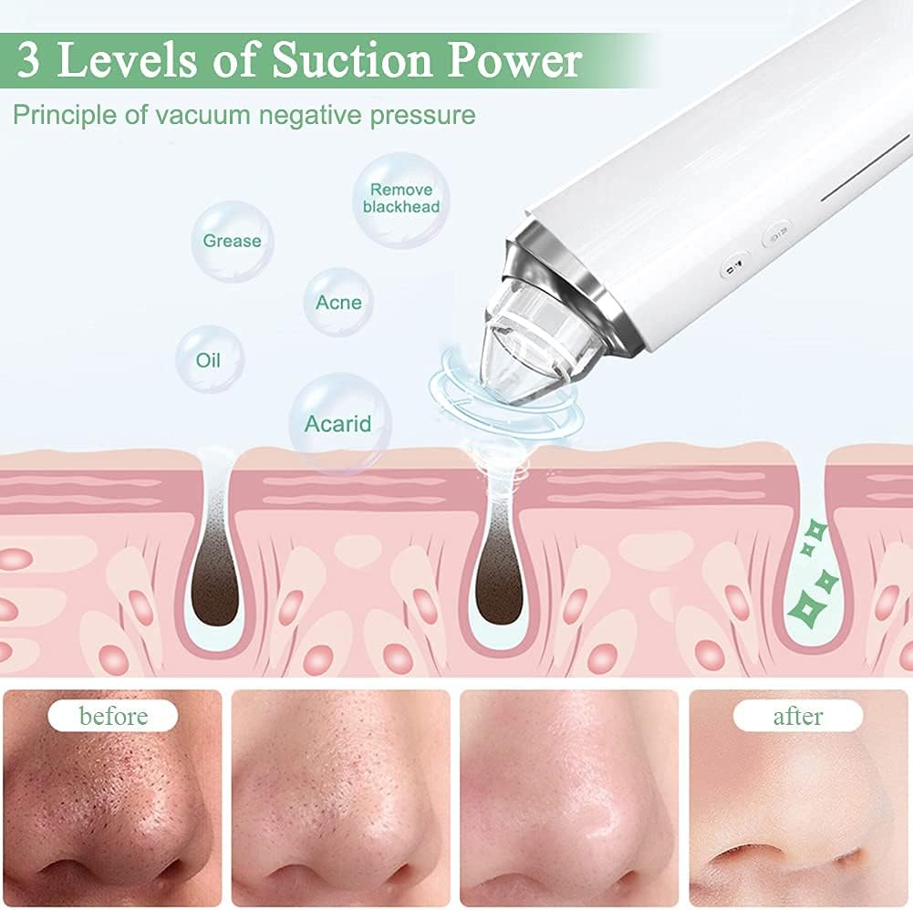 Blackhead Remover Vacuum - 5MP HD Camera & 20X Magnification | Electric Pore Cleanser Kit for Men & Women with 6 Probes