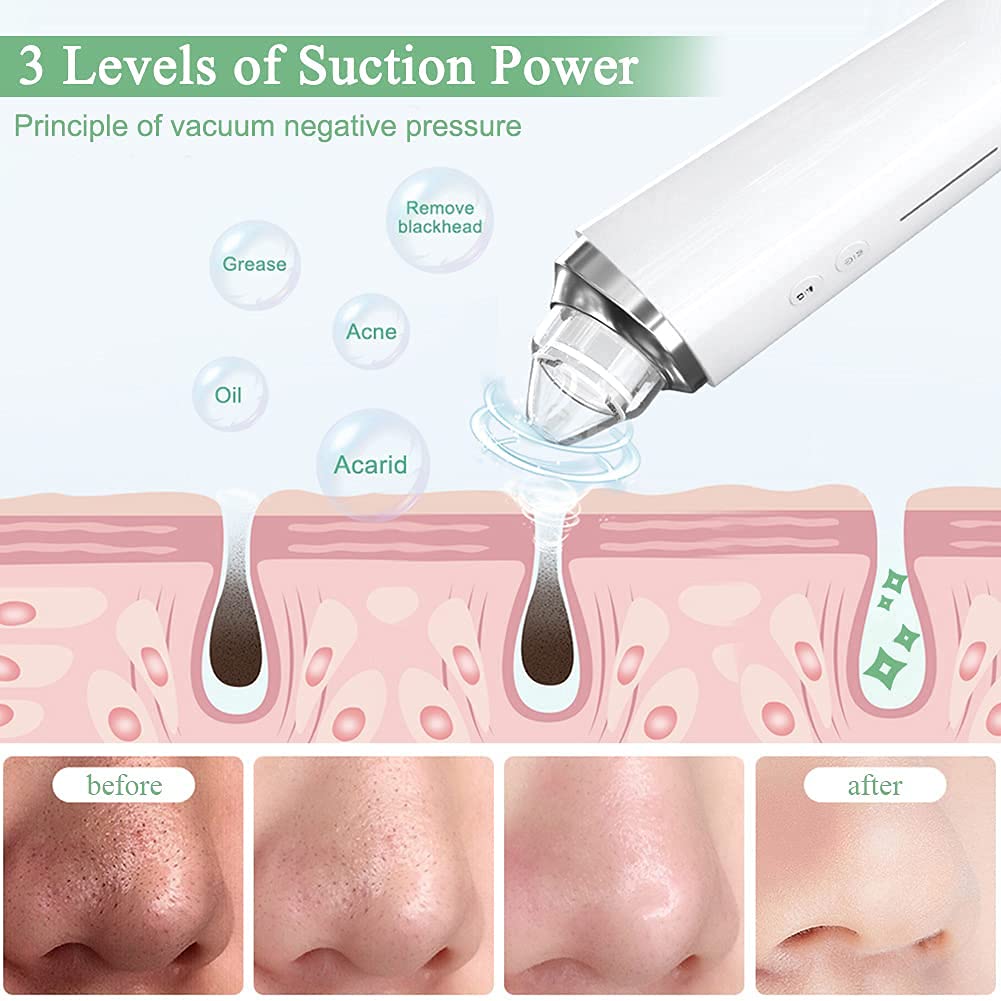 Blackhead Remover Pore Vacuum with 5MP HD Camera, 20X Magnification WiFi Visible Facial Pore Cleanser, FDA-Registered Electric Pimple Acne Comedone Extractor Kit for Men & Women with 6 Probes