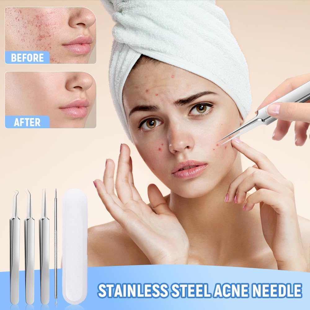 Professional Blackhead Remover Set - 7 Piece Stainless Steel Extraction Tools for Clear Skin