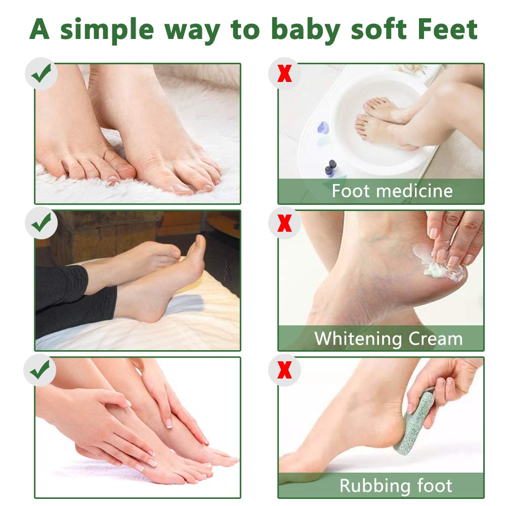 Liefiet Foot Peeling Mask 5 Pack, Foot Mask Remove Dead Skin, Rough Callus and Cracked Heels, Dry Skin Moisturizer for Soft and Smooth Baby Touch Feet (Tea Tree)