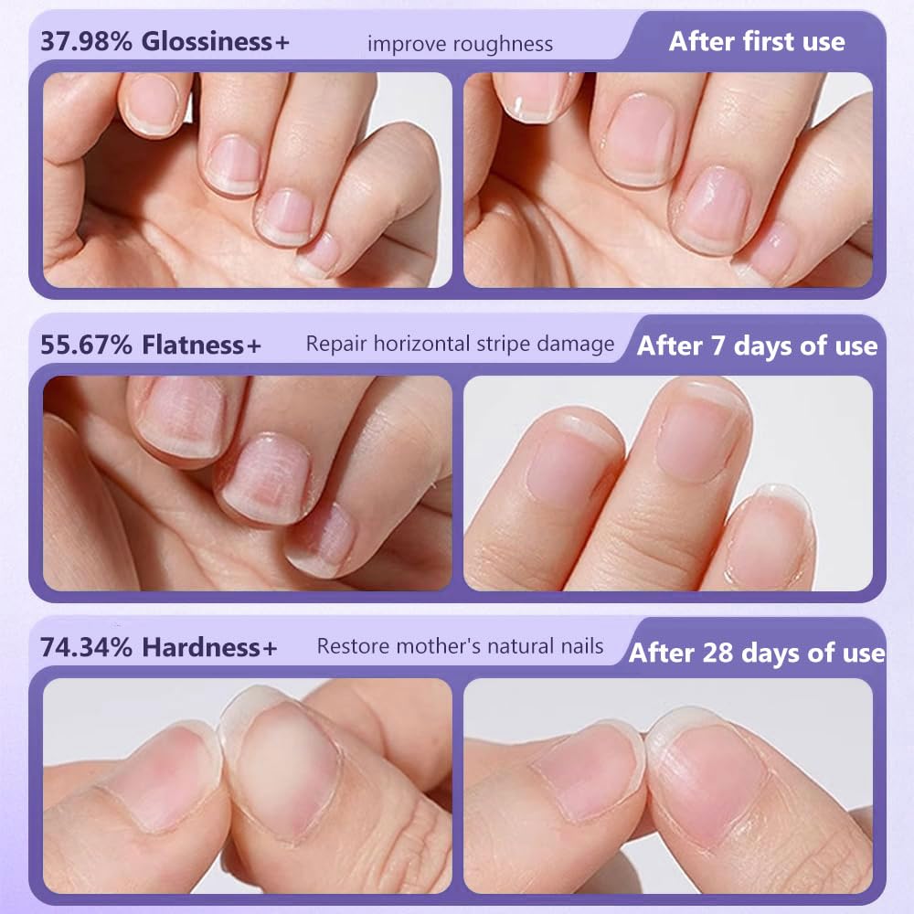 Nail Care Pen - 3-in-1 Cuticle Oil with Ceramic Tip for Hangnails & Dry Nails | Nourish & Strengthen (2 Pack)