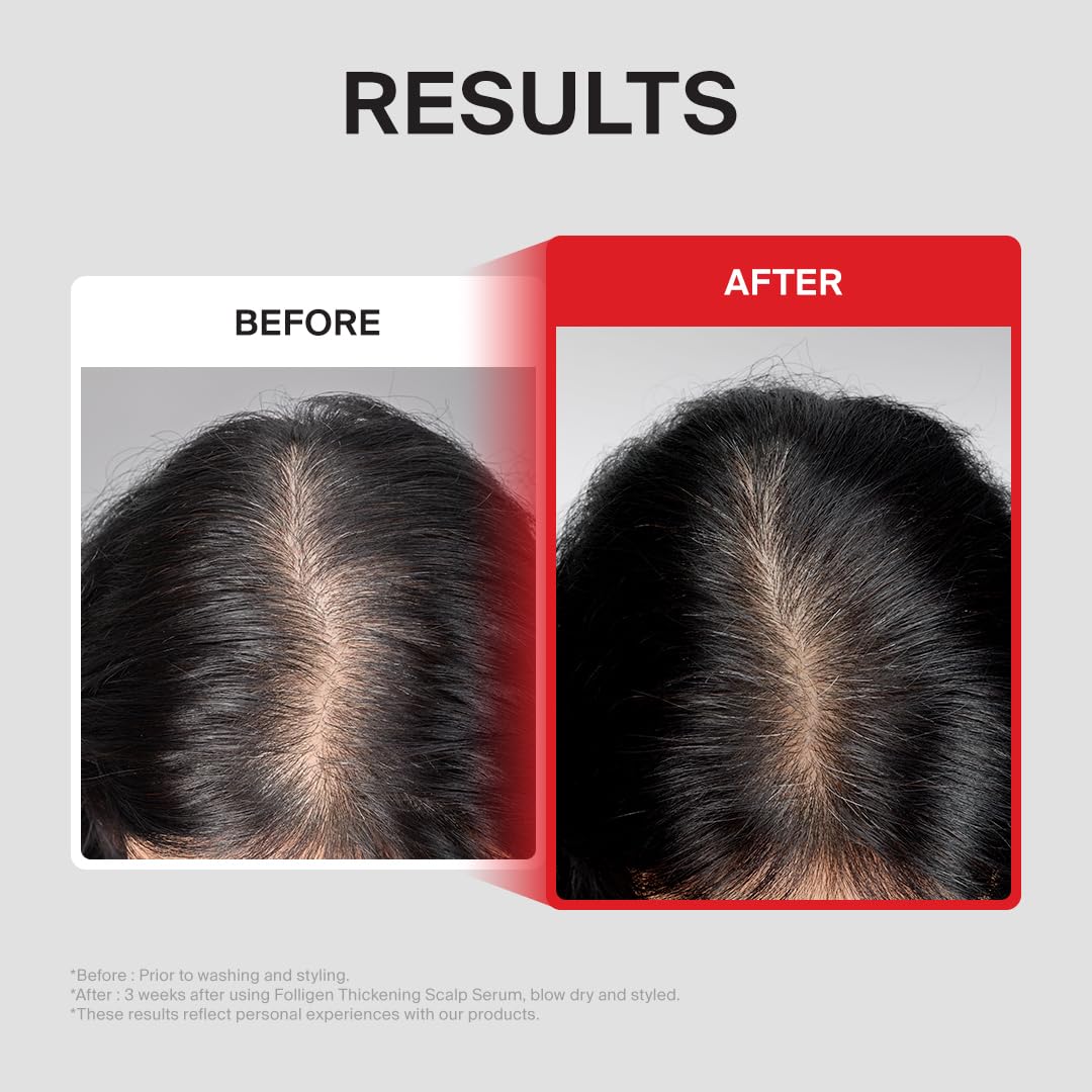 Dr.FORHAIR Folligen Thickening Scalp Serum - Biotin Peptide Treatment for Thicker Hair | 1.7 oz