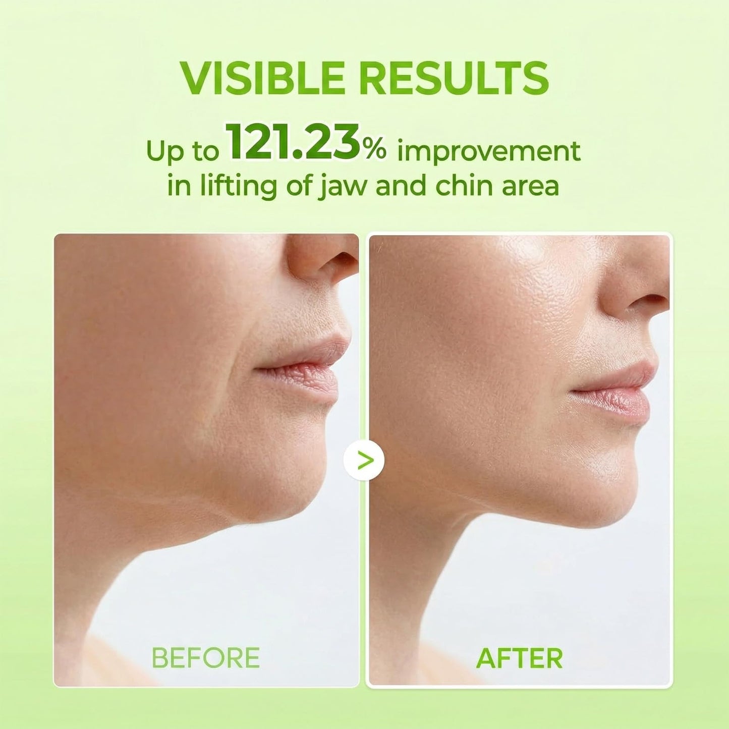 XPICZE CACTOX V-Lifting Mewing Band, Korean V-Line Facial Firming Mask with Caffeine & Collagen, Visibly Tones Jawline & Soothes Morning Puffiness, Snug Fit Contouring Skincare(2 boxes)