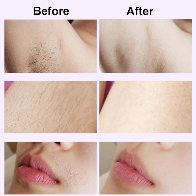 XYOUWEI 2 in 1 Bikini Trimmer for Women, Rechargeable Electric Razors for Women, Wet/Dry Use Lady Electric Shaver for Bikini Face Lip Underarm Legs Pubic Hair