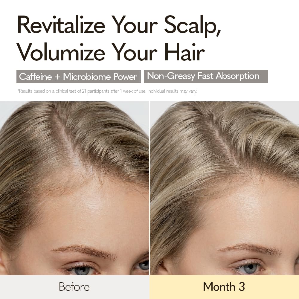 YUZY Scalp Revive Serum, Non-Greasy Scalp Serum for Thinning Hair with Biotin, Caffeine & Menthol, Microbiome Scalp Care for Fuller-Looking Hair & Growth Support | 1.69 fl.oz, 50ml