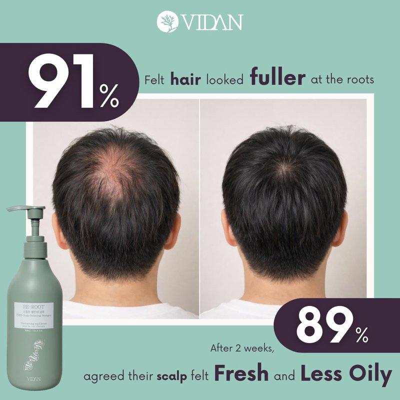 VIDAN RE:ROOT PDRN Scalp Balancing Shampoo, Korean Volumizing Shampoo & Repair for Thinning Hair, Cooling Menthol for Sensitive Scalp (10.14 Fl Oz)