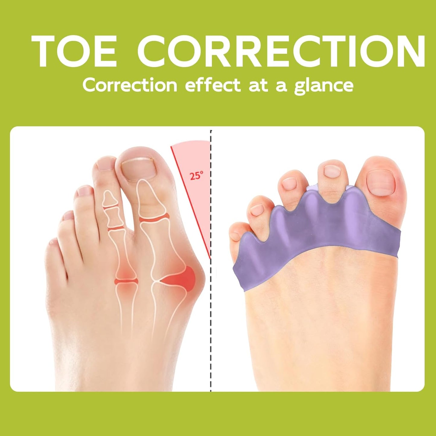 Silicone Toe Separators for Bunion Correction - 4 Pairs of Toe Spacers for Men & Women | Hammer Toe Straighteners, Lavender