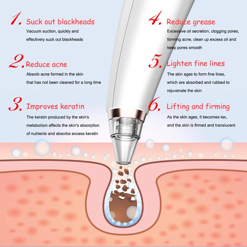 Blackhead Remover Pore Vacuum for Face & Nose, Blackhead Extractor with 3 Adjustable Suction Levels, 6 Removal Tools, USB Rechargeable Facial Pore Cleaner for Women & Men (White)